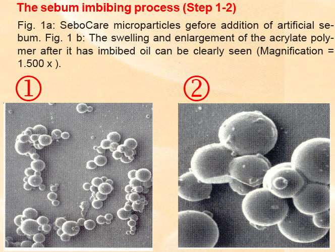 Zoom: sebumaufsaugende_prozess-schritte_der_vesikel..png
